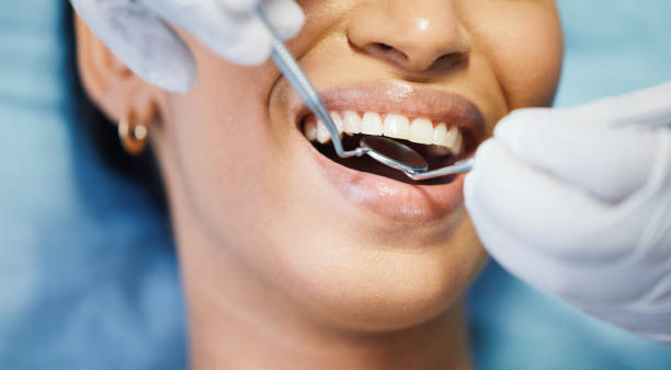 Best Same-Day Emergency Dental Services in Seal Beach, CA