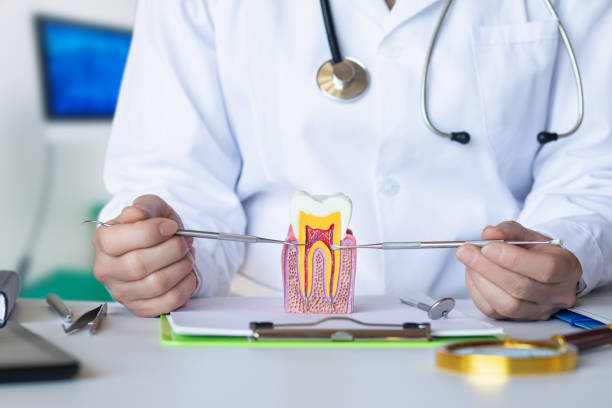 Best Emergency Wisdom Teeth Removal in Seal Beach, CA